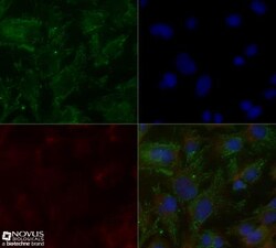 ApoE4 Antibody (4E4) - BSA Free, Novus Biologicals 0.1mL; Unlabeled:Antibodies,