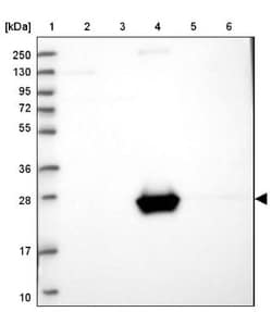 Apolipoprotein A-I/ApoA1 Antibody, Novus Biologicals 0.1mL; Unlabeled:Antibodies,