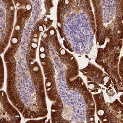 Apolipoprotein A-IV/ApoA4 Antibody, Novus Biologicals 25 &mu;L; Unlabeled:Antibodies,