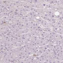 CMC2 Antibody, Novus Biologicals:Antibodies:Primary Antibodies