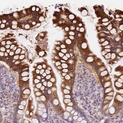 CMC2 Antibody, Novus Biologicals:Antibodies:Primary Antibodies