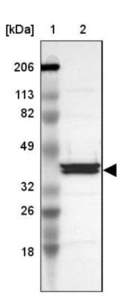 Apolipoprotein A-IV/ApoA4 Antibody, Novus Biologicals 25 &mu;L; Unlabeled:Antibodies,