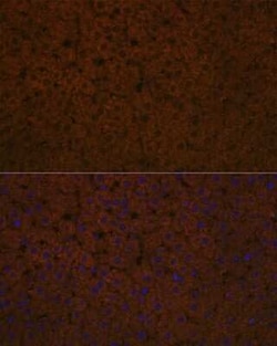 Apolipoprotein CIII Rabbit anti-Human, Mouse, Rat, Clone: 3T7Y5, Novus Biologicals 100 &mu;g | Buy Online | Bio-Techne | Fisher Scientific