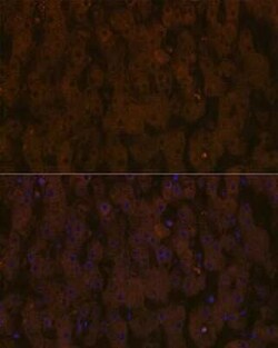 Apolipoprotein CIII Rabbit anti-Human, Mouse, Rat, Clone: 3T7Y5, Novus Biologicals 100 &mu;g | Buy Online | Bio-Techne | Fisher Scientific