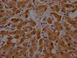 Apolipoprotein CIII Antibody (8H12), Novus Biologicals 100 &mu;g; Unconjugated:Antibodies,