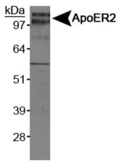 Apolipoprotein E R2/ApoE R2 Antibody, Novus Biologicals:Antibodies:Primary