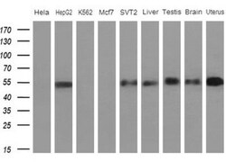 Apolipoprotein H/ApoH Antibody (OTI4A11), Novus Biologicals 0.1 mL | Buy Online | Novus Biologicals | Fisher Scientific