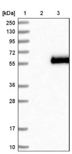 Apolipoprotein H/ApoH Antibody, Novus Biologicals 25 &mu;L; Unlabeled:Antibodies,