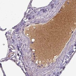 Apolipoprotein L1 Antibody (CL0171), Novus Biologicals 25 &mu;L, Unlabeled:Antibodies,