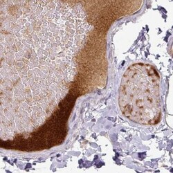 Apolipoprotein L1 Antibody (CL0171), Novus Biologicals 25 &mu;L, Unlabeled:Antibodies,