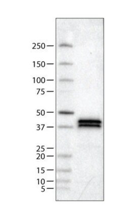 Apolipoprotein L1 Antibody (CL0171), Novus Biologicals 25 &mu;L, Unlabeled:Antibodies,
