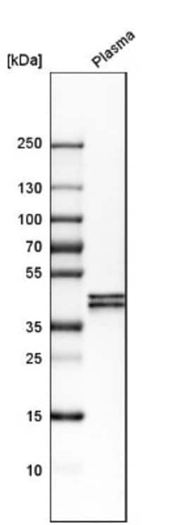 Apolipoprotein L1 Antibody, Novus Biologicals 25 &mu;L | Buy Online | Novus Biologicals | Fisher Scientific