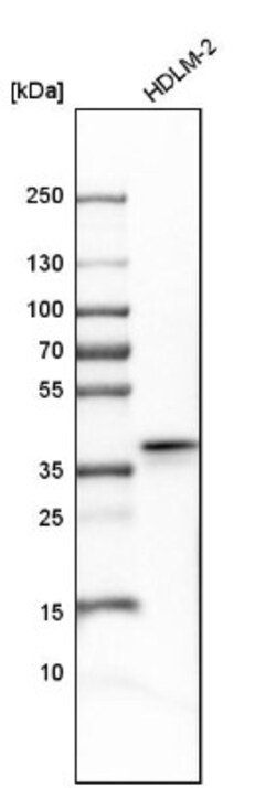 Apolipoprotein L2 Antibody, Novus Biologicals:Antibodies:Primary Antibodies
