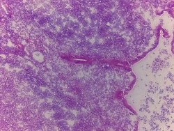 Novus Biologicals Appendix Tissue Slides (Adult Normal)- Frozen 5 Slides | Buy Online | Novus Biologicals&trade; | Fisher Scientific