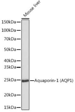 Aquaporin 1/AQP1 Rabbit anti-Human, Mouse, Rat, Clone: 8V1O3, Novus Biologicals 20 &mu;g | Buy Online | Novus Biologicals | Fisher Scientific