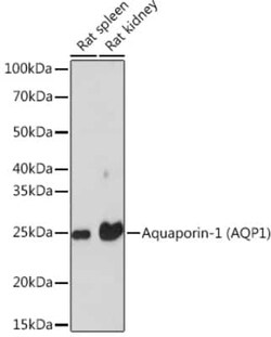 Aquaporin 1/AQP1 Rabbit anti-Human, Mouse, Rat, Clone: 8V1O3, Novus Biologicals 20 &mu;g | Buy Online | Novus Biologicals | Fisher Scientific