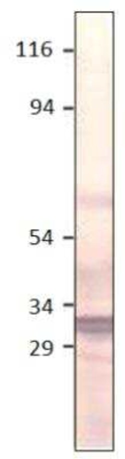 Aquaporin-11 Antibody, Novus Biologicals 100 &mu;g | Buy Online | Novus Biologicals | Fisher Scientific