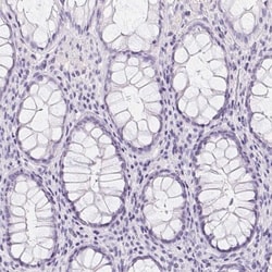 Aquaporin-2 Antibody, Novus Biologicals 0.1mL; Unlabeled:Antibodies, Polyclonal