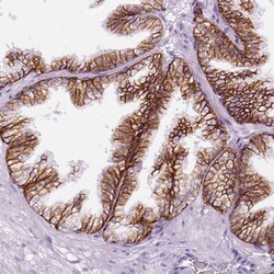 Aquaporin-3 Antibody, Novus Biologicals 0.1mL; Unlabeled:Antibodies, Polyclonal