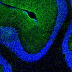 Aquaporin-4 Antibody, Novus Biologicals:Antibodies:Primary Antibodies