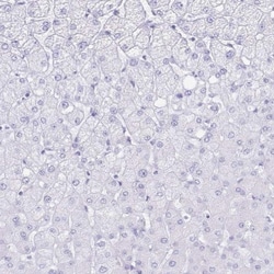 Aquaporin-4 Antibody, Novus Biologicals:Antibodies:Primary Antibodies