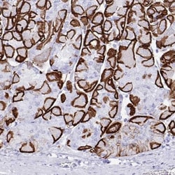 Aquaporin-4 Antibody, Novus Biologicals:Antibodies:Primary Antibodies