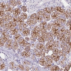 Aquaporin-5 Antibody, Novus Biologicals 25 &mu;L, Unlabeled:Antibodies,