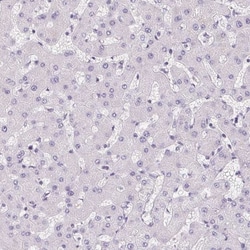 Aquaporin-5 Antibody, Novus Biologicals 25 &mu;L, Unlabeled:Antibodies,