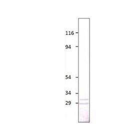 Aquaporin-5 Antibody, Novus Biologicals 100 &mu;g | Buy Online | Bio-Techne | Fisher Scientific