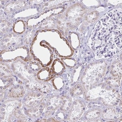 Aquaporin-6 Antibody, Novus Biologicals:Antibodies:Primary Antibodies