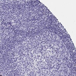 Aquaporin-6 Antibody, Novus Biologicals:Antibodies:Primary Antibodies