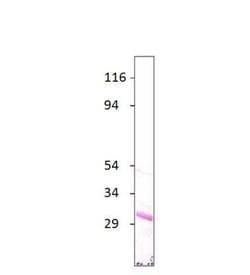Aquaporin-7 Antibody, Novus Biologicals 100 &mu;g | Buy Online | Bio-Techne | Fisher Scientific