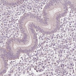 Aquaporin-8 Antibody, Novus Biologicals 25 &mu;L; Unlabeled:Antibodies,