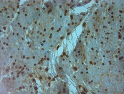 Aquaporin-9 Antibody, Novus Biologicals 0.1 mL; Unconjugated:Antibodies,