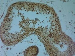 Aquaporin-9 Antibody, Novus Biologicals 0.1 mL; Unconjugated:Antibodies,