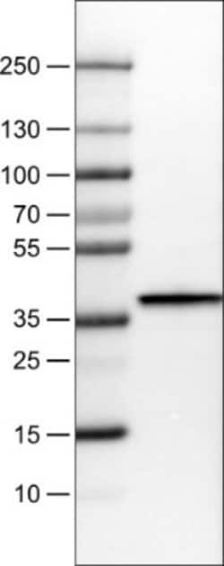 Arginase 1/ARG1/liver Arginase Antibody (CL0186), Novus Biologicals 25