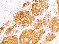 Arginase 1/ARG1/liver Arginase Antibody (ARG1/1125 + ARG1/1126), Novus