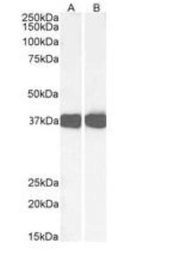 Arginase 1/ARG1/liver Arginase Antibody, Novus Biologicals 0.1mg; Unlabeled:Antibodies,