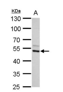 Arginine decarboxylase Antibody, Novus Biologicals 0.1mL; Unlabeled:Antibodies,