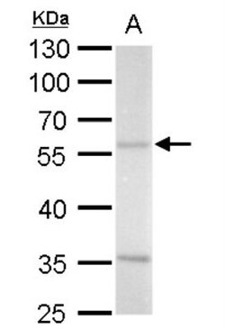 Arginine decarboxylase Antibody, Novus Biologicals 0.1mL; Unlabeled:Antibodies,