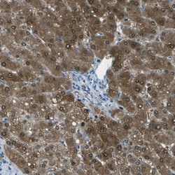 Argininosuccinate Lyase Antibody, Novus Biologicals:Antibodies:Primary