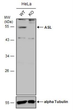 Argininosuccinate Lyase Antibody, Novus Biologicals 0.1mg; Unlabeled:Antibodies,