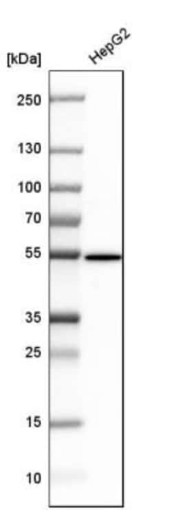 Argininosuccinate Lyase Antibody, Novus Biologicals:Antibodies:Primary