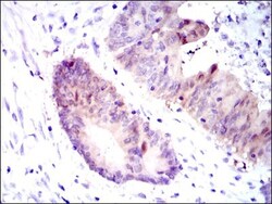 Argininosuccinate Synthase Antibody (2C10) - BSA Free, Novus Biologicals:Antibodies:Primary