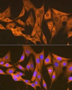 Argininosuccinate Synthase Rabbit anti-Human, Mouse, Rat, Clone: 4W1M8, Novus Biologicals 20 &mu;g | Buy Online | Novus Biologicals | Fisher Scientific