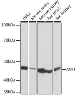 Argininosuccinate Synthase Rabbit anti-Human, Mouse, Rat, Clone: 4W1M8, Novus Biologicals 20 &mu;g | Buy Online | Novus Biologicals | Fisher Scientific