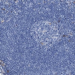 Argininosuccinate Synthase Antibody, Novus Biologicals 0.1mL; Unlabeled:Antibodies,