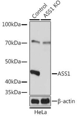 Argininosuccinate Synthase Rabbit anti-Human, Mouse, Rat, Polyclonal, Novus Biologicals 20 &mu;g | Buy Online | Novus Biologicals | Fisher Scientific