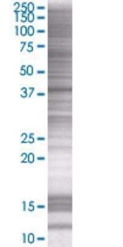 Novus Biologicals Arrestin 3 293T Cell Transient Overexpression Lysate 0.1 mL | Buy Online | Novus Biologicals&trade; | Fisher Scientific
