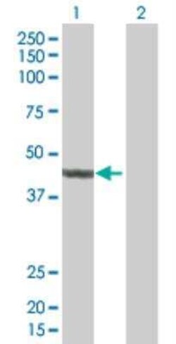Novus Biologicals Arrestin 3 293T Cell Transient Overexpression Lysate 0.1 mL | Buy Online | Novus Biologicals&trade; | Fisher Scientific